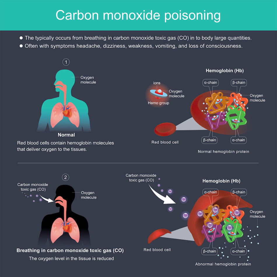 signs of carbon monoxide poisoning treatment